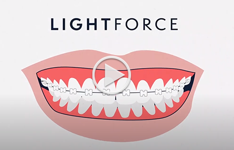 Ligthforce DiCosimo Orthodontics in Manlius, NY